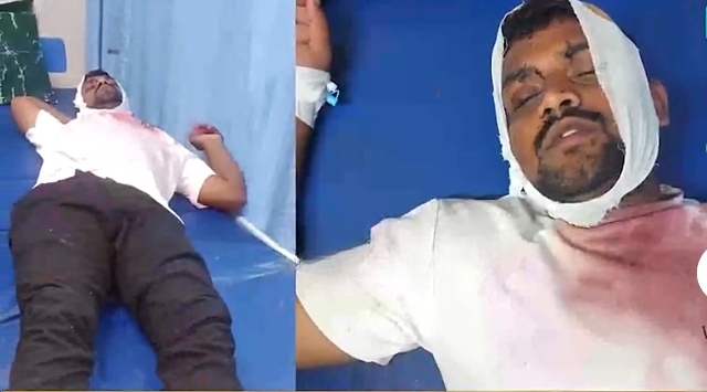 ಬೆಳಗಾವಿ | ದಲಿತ ಮಹಿಳೆಗೆ ನೀರು ಎರಚಿದ್ದನ್ನು ಪ್ರಶ್ನಿಸಿದಕ್ಕೆ ಯುವಕನ ಮೇಲೆ ಹಲ್ಲೆ