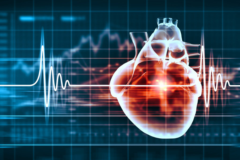 ECG 1