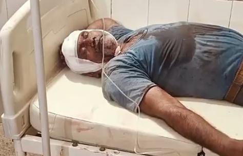ಬೆಳಗಾವಿ | ಆಸ್ತಿ ವಿಚಾರವಾಗಿ ತಂಗಿ ಮತ್ತು ಅಣ್ಣಂದಿರ ಮಧ್ಯೆ ಗಲಾಟೆ: ನಾಲ್ವರಿಗೆ ಗಂಭೀರ ಗಾಯ