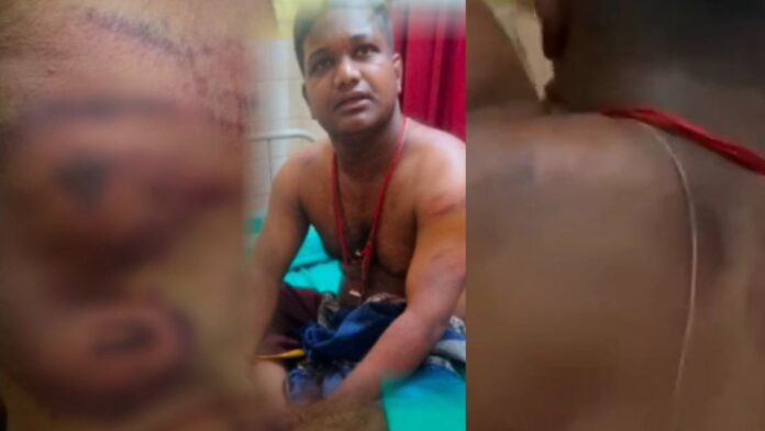 ಉಡುಪಿ | ಮನೆಯಲ್ಲಿ ಕೂಡಿ ಹಾಕಿ ಯಕ್ಷಗಾನ ಕಲಾವಿದನ ಮೇಲೆ ಹಲ್ಲೆ, ದೂರು ದಾಖಲು