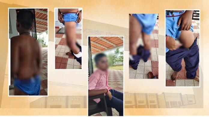 ಮುಳಬಾಗಿಲು ತಾಲೂಕಿನ ಮೊರಾರ್ಜಿ ದೇಸಾಯಿ ವಸತಿ ನಿಲಯದ ಘಟನೆ
